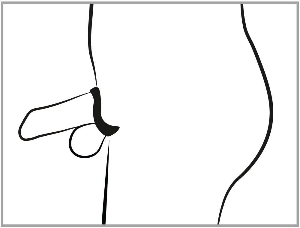 Klatka na penisa plus dilator — zdjęcie 6